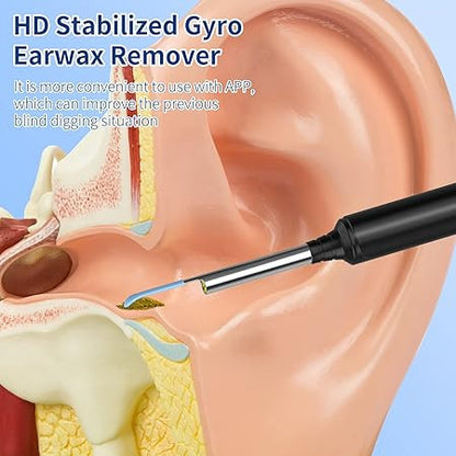 EAR CLEANER WITH CAMERA